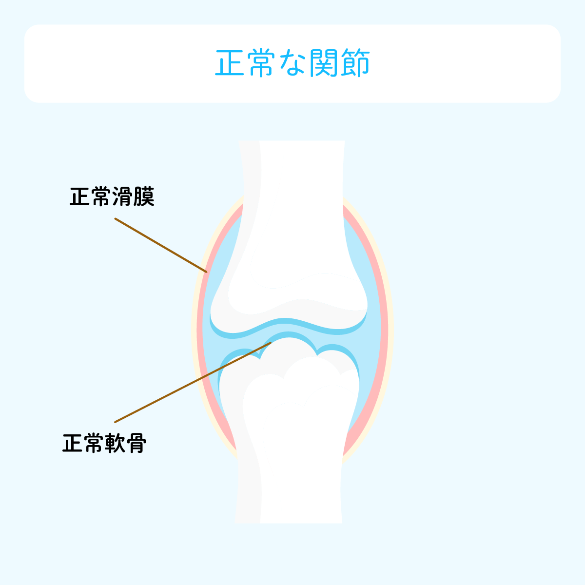 正常な関節